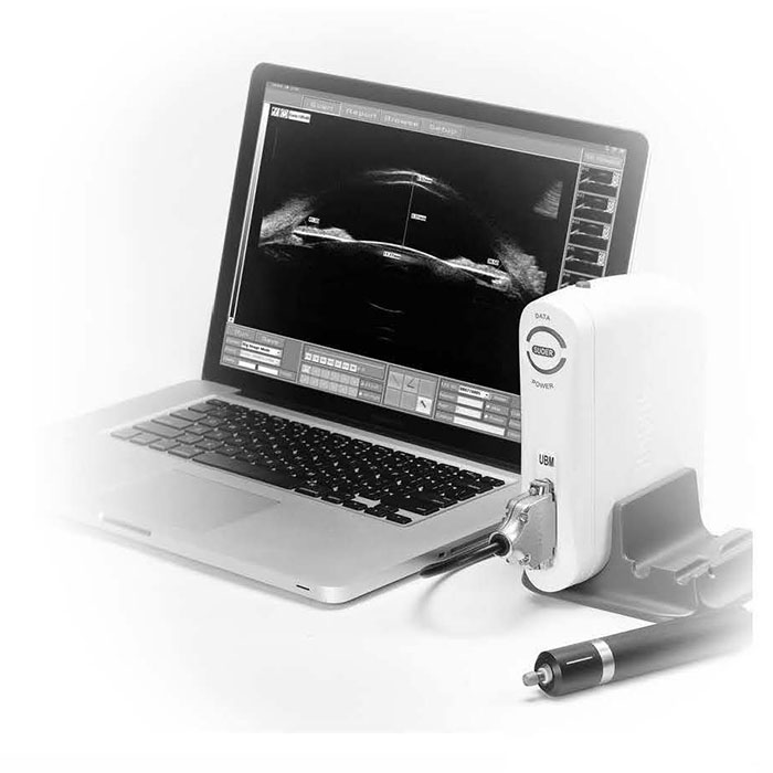 SW-3200S Full Scale UBM Ultrasound